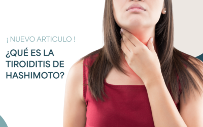Tiroiditis de Hashimoto: qué es, síntomas y tratamiento en Cartagena